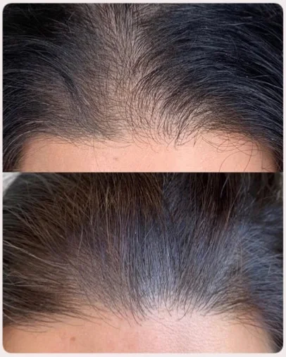 before-after-aoi